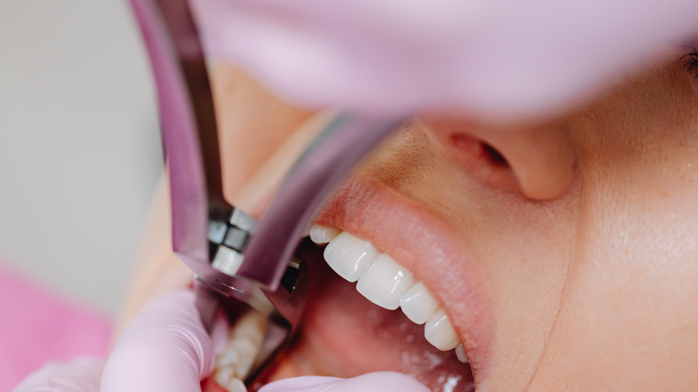 Tooth Crown Before and After